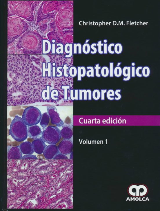 Diagnostico Histopatologico De Tumores
