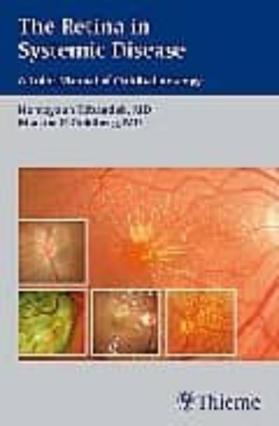 The Retina In Systemic Disease: A Color Manual Of Ophtalmoscopy