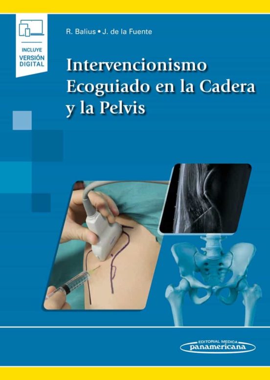 Intervencionismo Ecoguiado En La Cadera Y La Pelvis