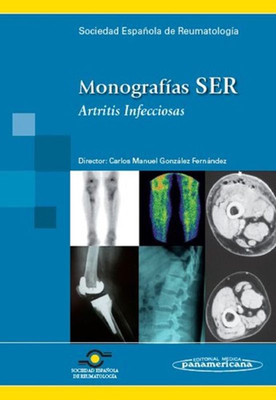 Monografias Ser: Artritis Infecciosa