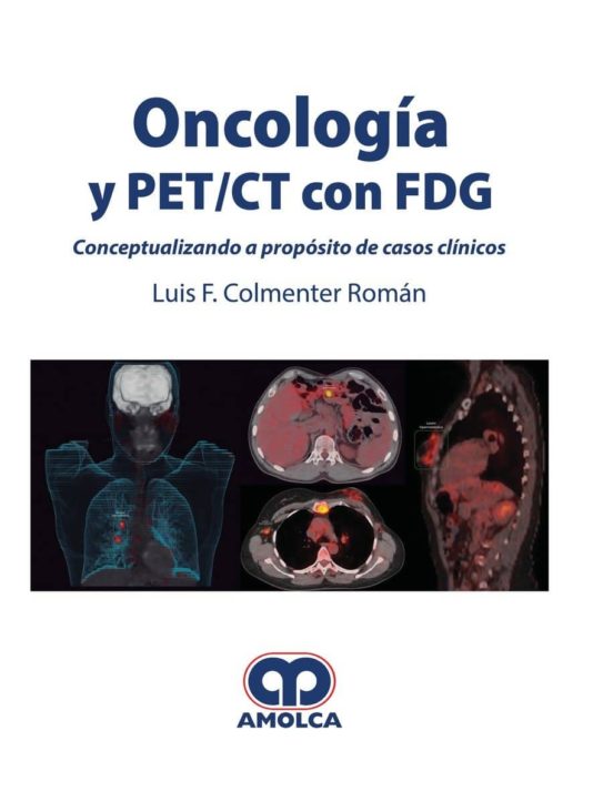 Oncología Y Pet/ct Con Fdg
