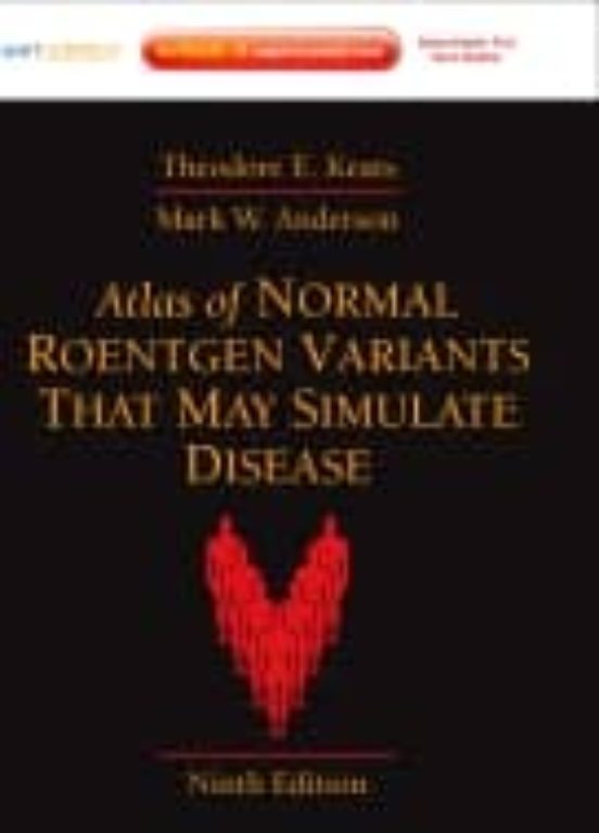 Atlas Of Normal Roentgen Variants That May Simulate Disease