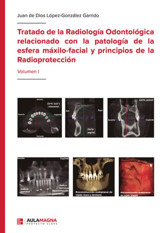 Tratado De La Radiología Odontológica Relacionado Con La Patología De