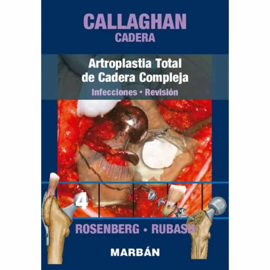 Cadera 4. Artroplastia Total De Cadera Compleja. Infecciones. Revisión