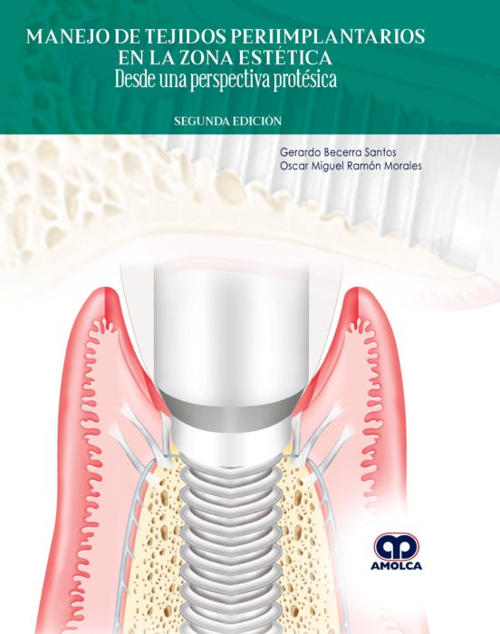 Manejo De Tejidos Periimplantarios En La Zona Estetica: Desde Una Pers
