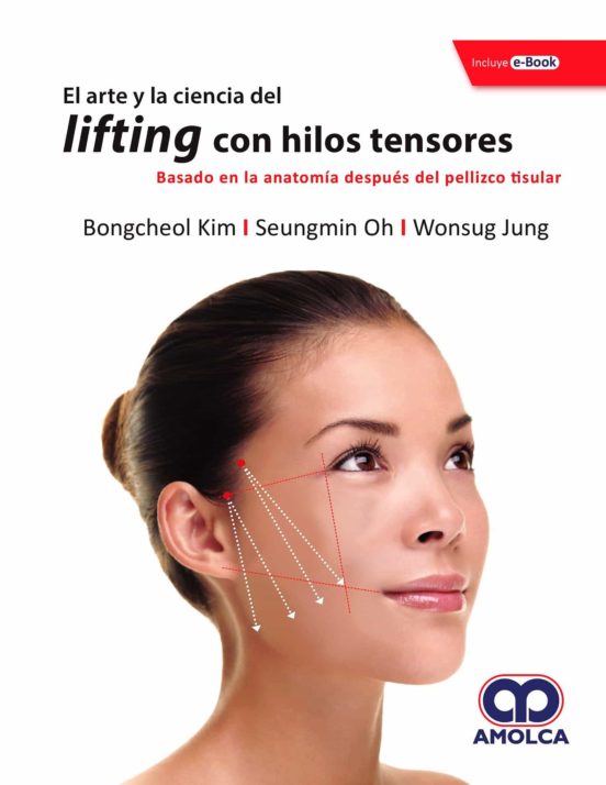 El Arte Y La Ciencia Del Lifting Con Hilos Tensores. Basado En La Anat