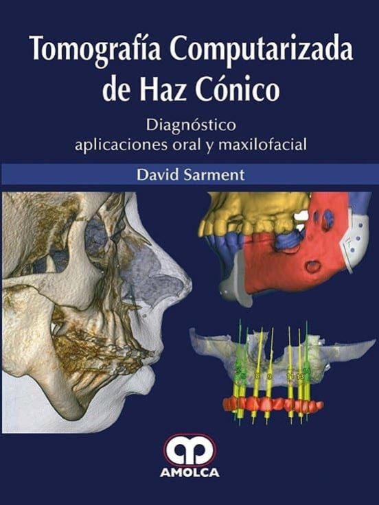 Tomografia Computarizada De Haz Conico