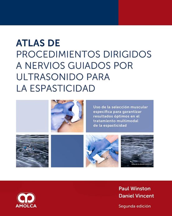 Atlas de procedimientos dirigidos a nervios guiados por ultrasonido para la espasticidad