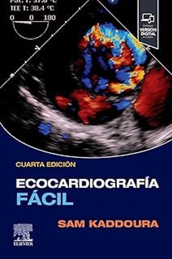 Ecocardiografía Fácil