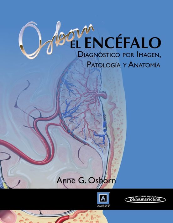 El Encefalo. Diagnostico Por Imagen Patologia Y Anatomia