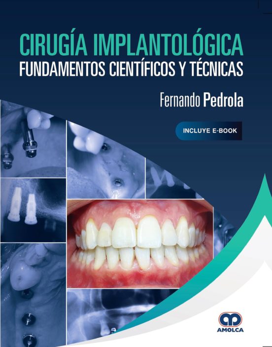 Cirugía Implantológica. Fundamentos Científicos Y Técnicas
