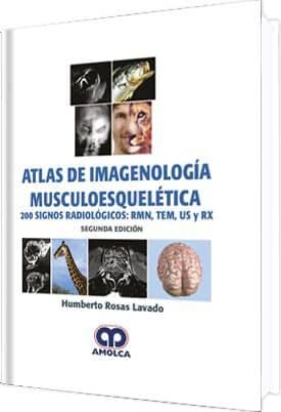 Atlas De Imagenologia Musculoesqueletica: 200 Signos Radiologicos : Rm