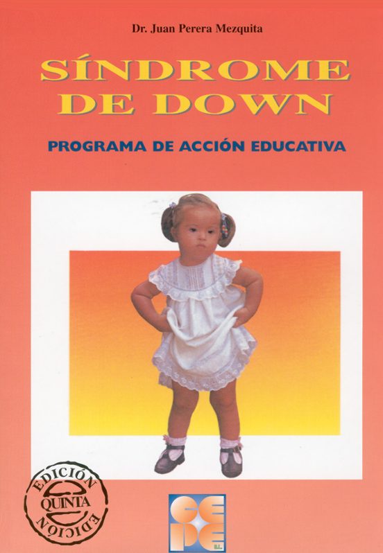 El Sindrome De Down