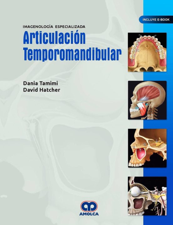 Articulación Temporomandibular. Imagenología Especializada