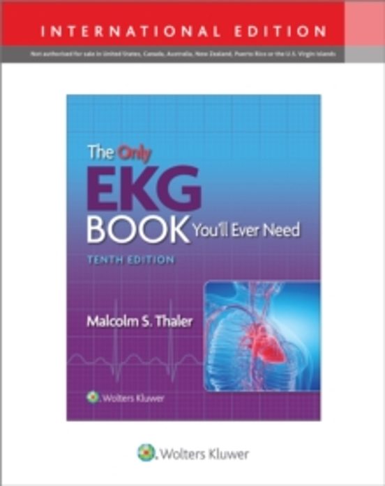 The Only Ekg Book Youll Ever Need
