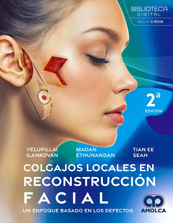 Colgajos Locales En Reconstrucción Facial. Un Enfoque Basado En Los De