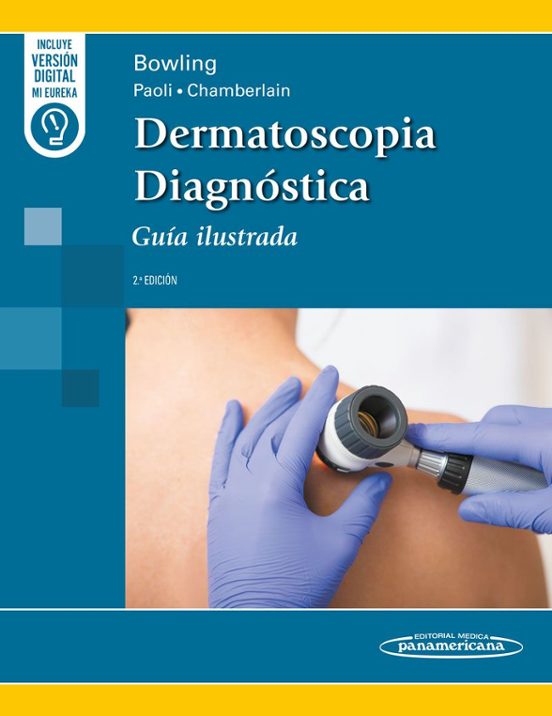 Dermatoscopia Diagnóstica