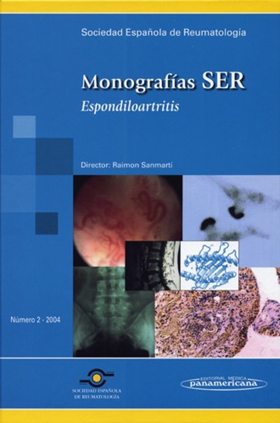 Monografia Ser: Nº 2 : Espondiloartritis