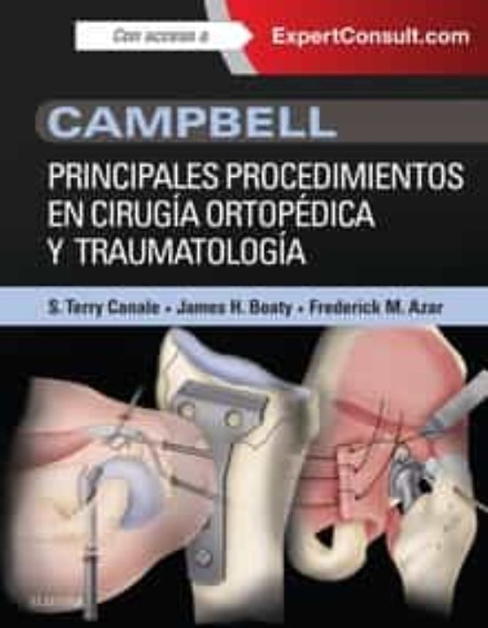 Campbell. Principales Procedimientos En Cirugía Ortopédica Y Traumatol