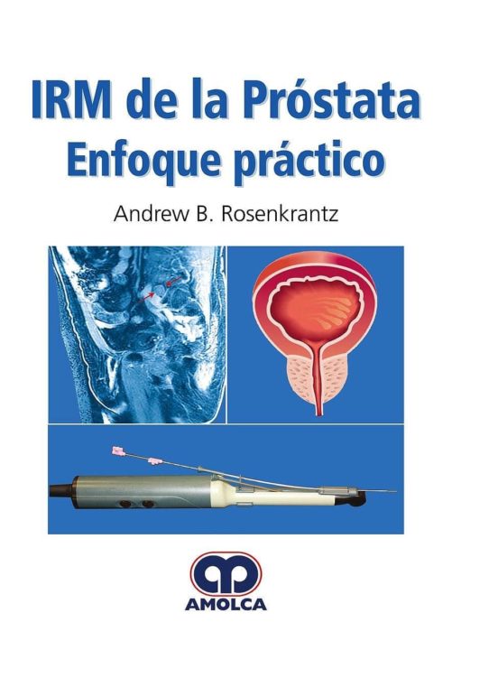 Irm De La Prostata: Enfoque Practico