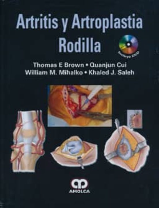 Artitris Y Artroplastia De Rodilla + Dvd