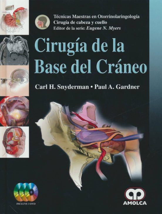 Cirugia De La Base Del Craneo