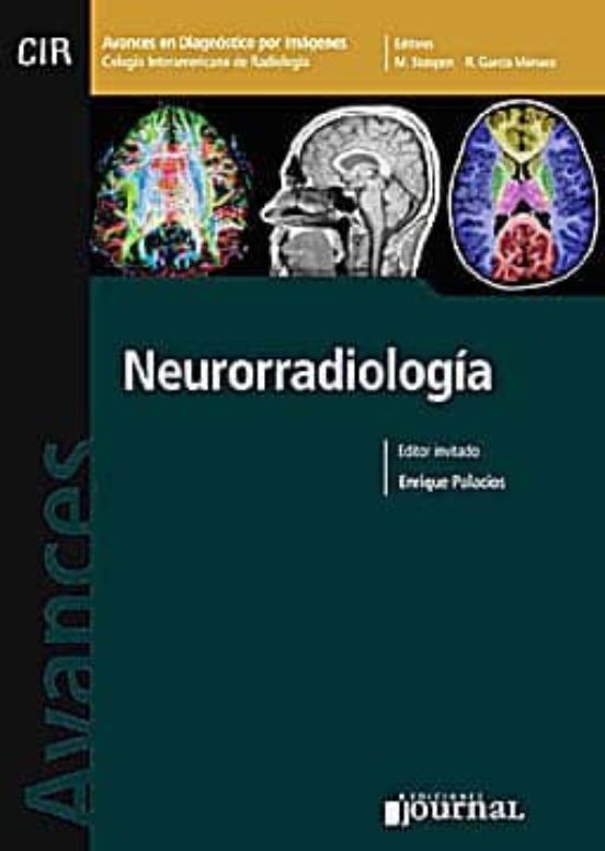 Avances En Diagnostico Por Imagenes 4: Neuroradiologia