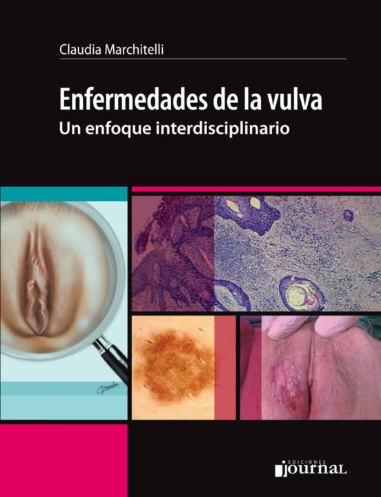 Enfermedades De La Vulva