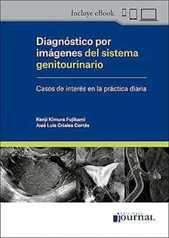 Diagnostico Por Imagenes Del Sistema Genitourinario