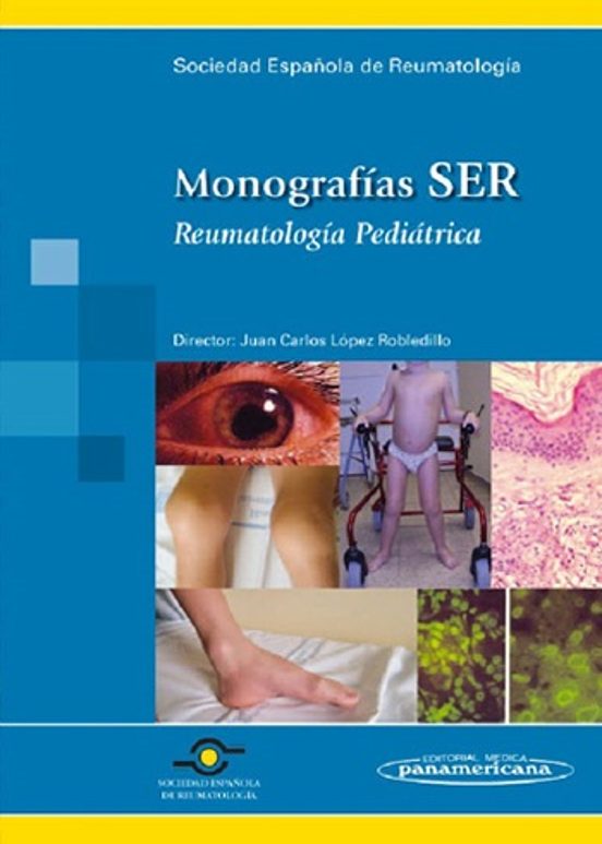 Monografías Ser. Reumatología Pediátrica