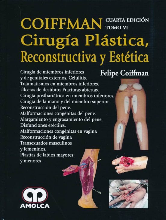 Coiffman Cirugia Plastica Reconstructiva Y Estetica Tomo Vi