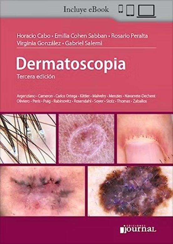 Dermatoscopia
