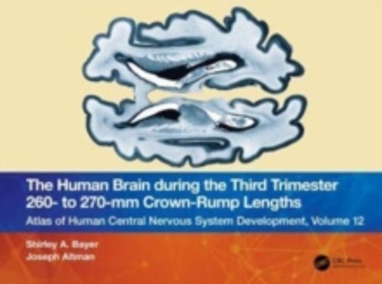 The Human Brain During The Third Trimester 260a To 270amm Cro Wn-rump