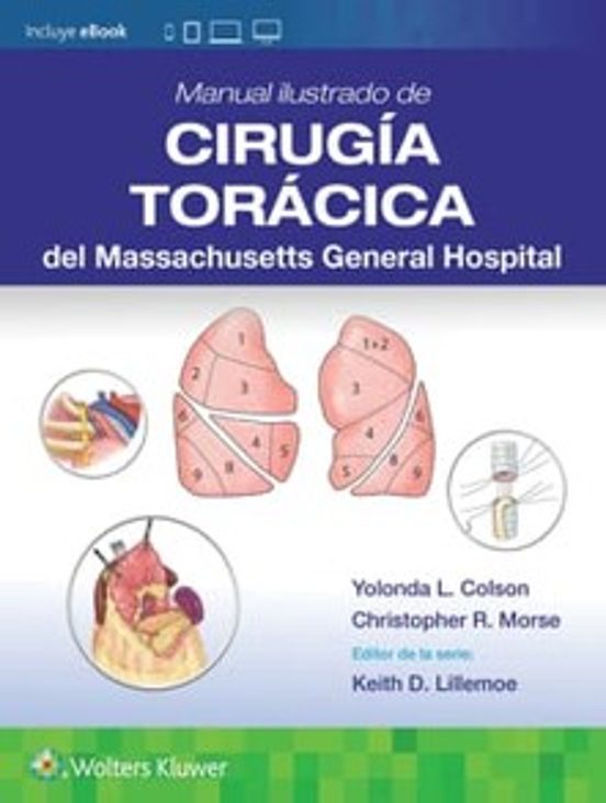 Manual Ilustrado De Cirugía Torácica De Massachusetts General Hos Pita