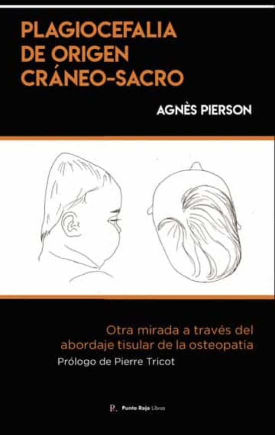 Plagiocefalia De Origen Craneo-sacro