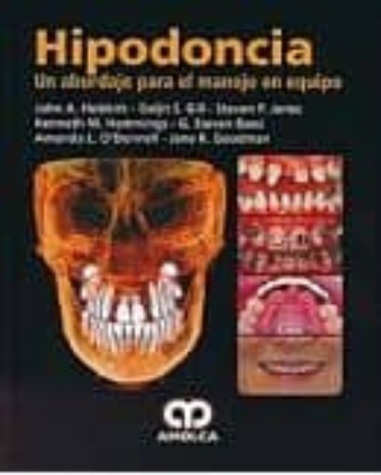 Hipodoncia: Un Abordaje Para El Manejo En Equipo