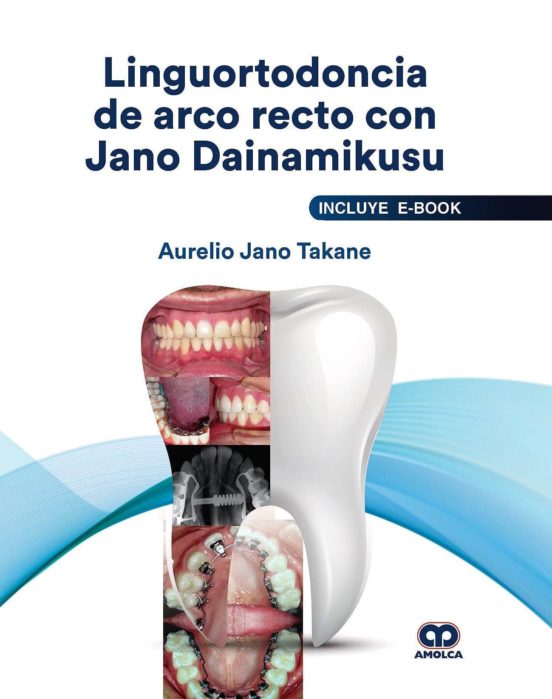 Linguortodoncia De Arco Recto Con Jano Dainamikusu