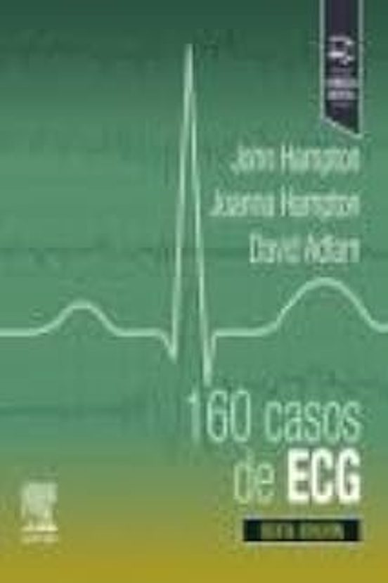 160 Casos De ECG