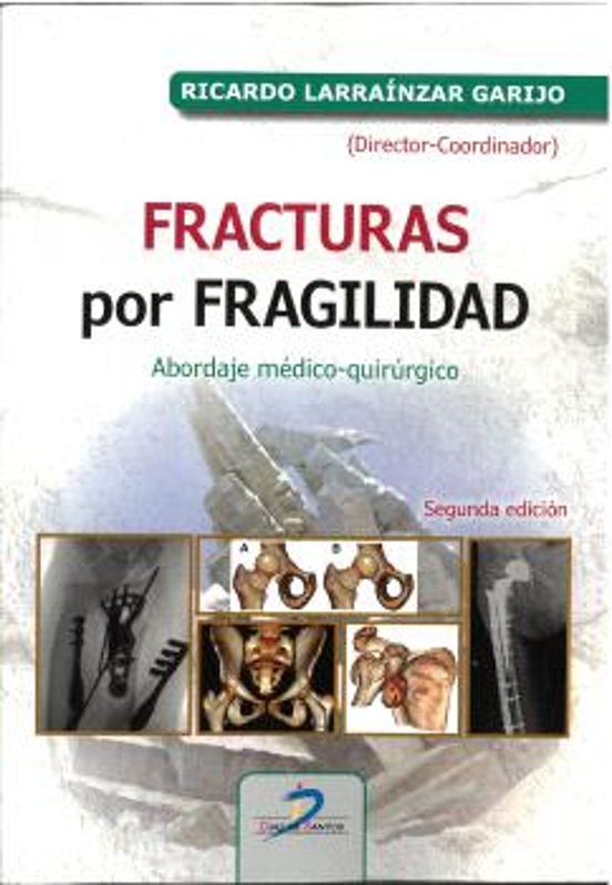 Fracturas Por Fragilidad