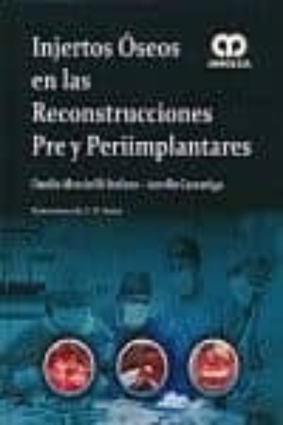 Injertos Oseos En Las Reconstrucciones Pre Y Periimplantares