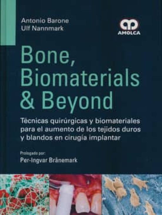 Bone Biomaterials And Beyond. Tecnicas Quirurgicas Y Biomateriales Par