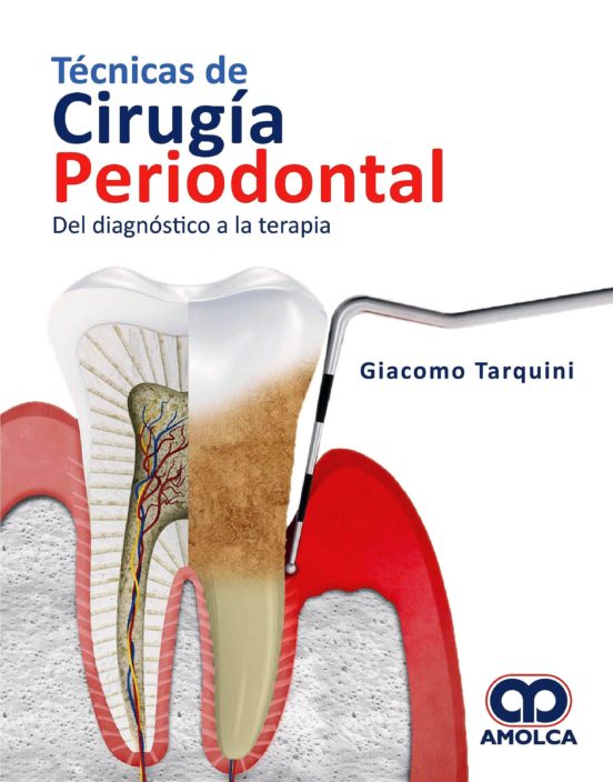 Técnicas De Cirugia Periodontal. Del Diagnostico A La Terapia