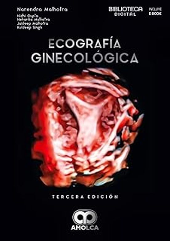 Ecografía Ginecológica