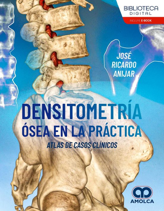 Densitometría ósea en la práctica. Atlas de casos clínicos