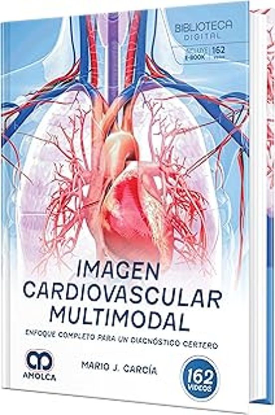 Imagen Cardiovascular Multimodal