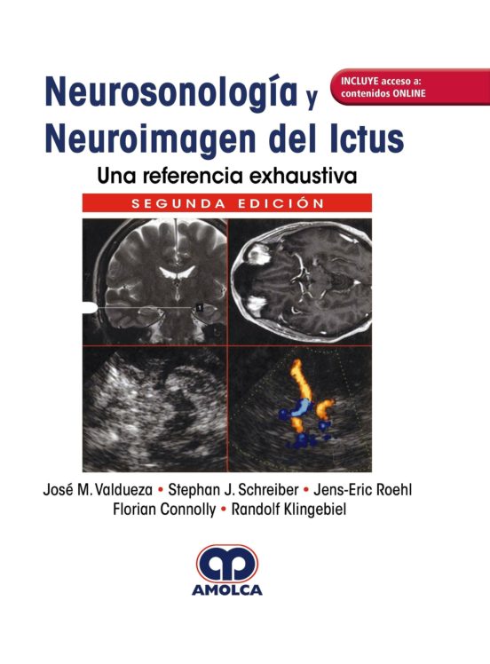 Neurosonología Y Neuroimagen Del Ictus. Una Referencia Exhaustiva + Ac