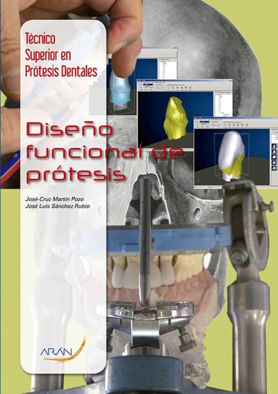Diseño Funcional De Protesis