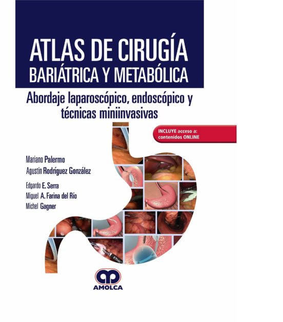 Atlas De Cirugía Bariátrica Y Metabólica. Abordaje Laparoscópico Endos
