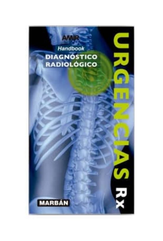 Urgencias Rx: Handbook: Diagnostico Radiologico