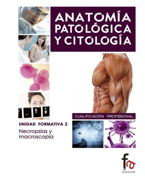 Anatomia Patologica Y Citologia: Necropsias Y Macroscopia